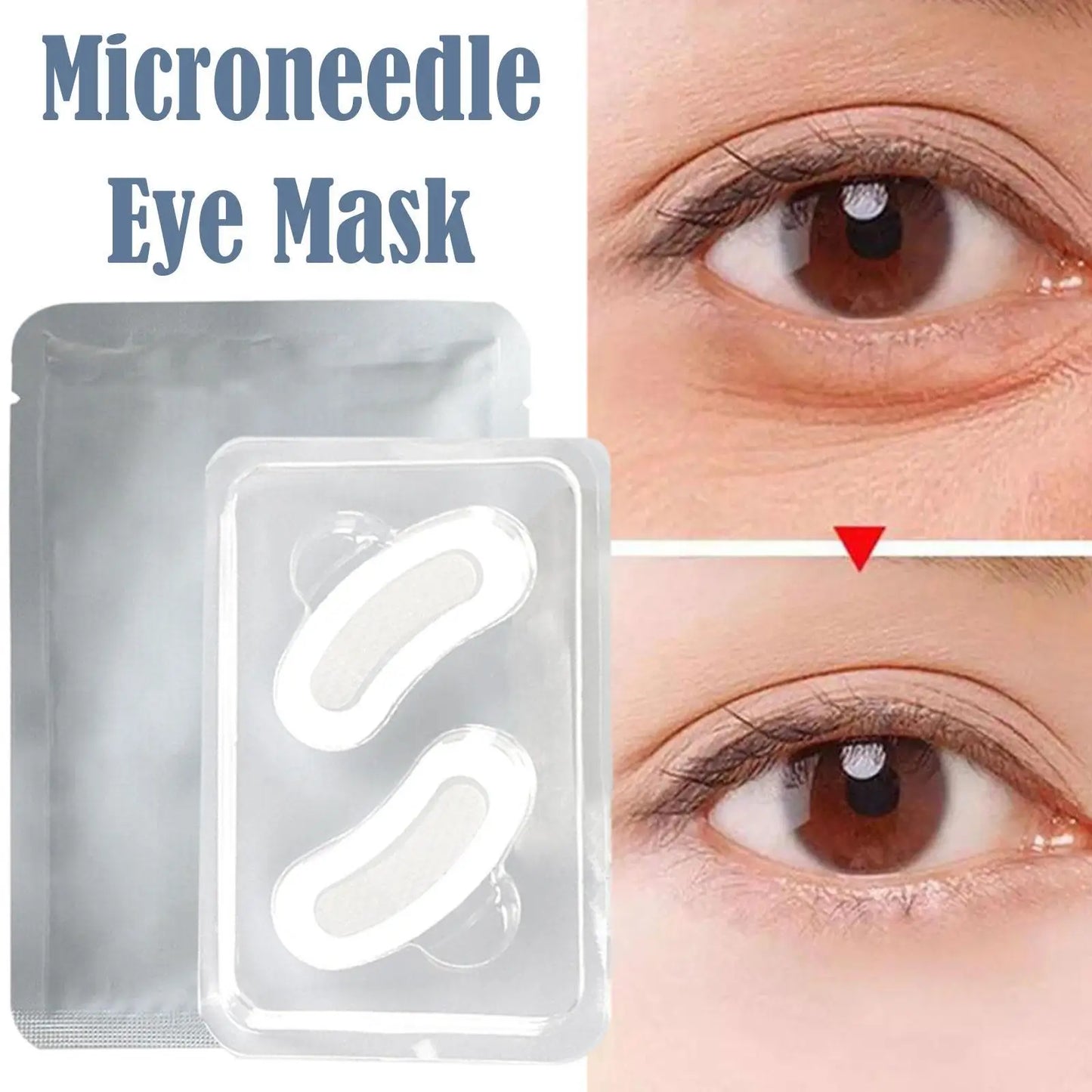 Parches con microagujas de ácido hialurónico – para arrugas, ojeras y líneas de expresión