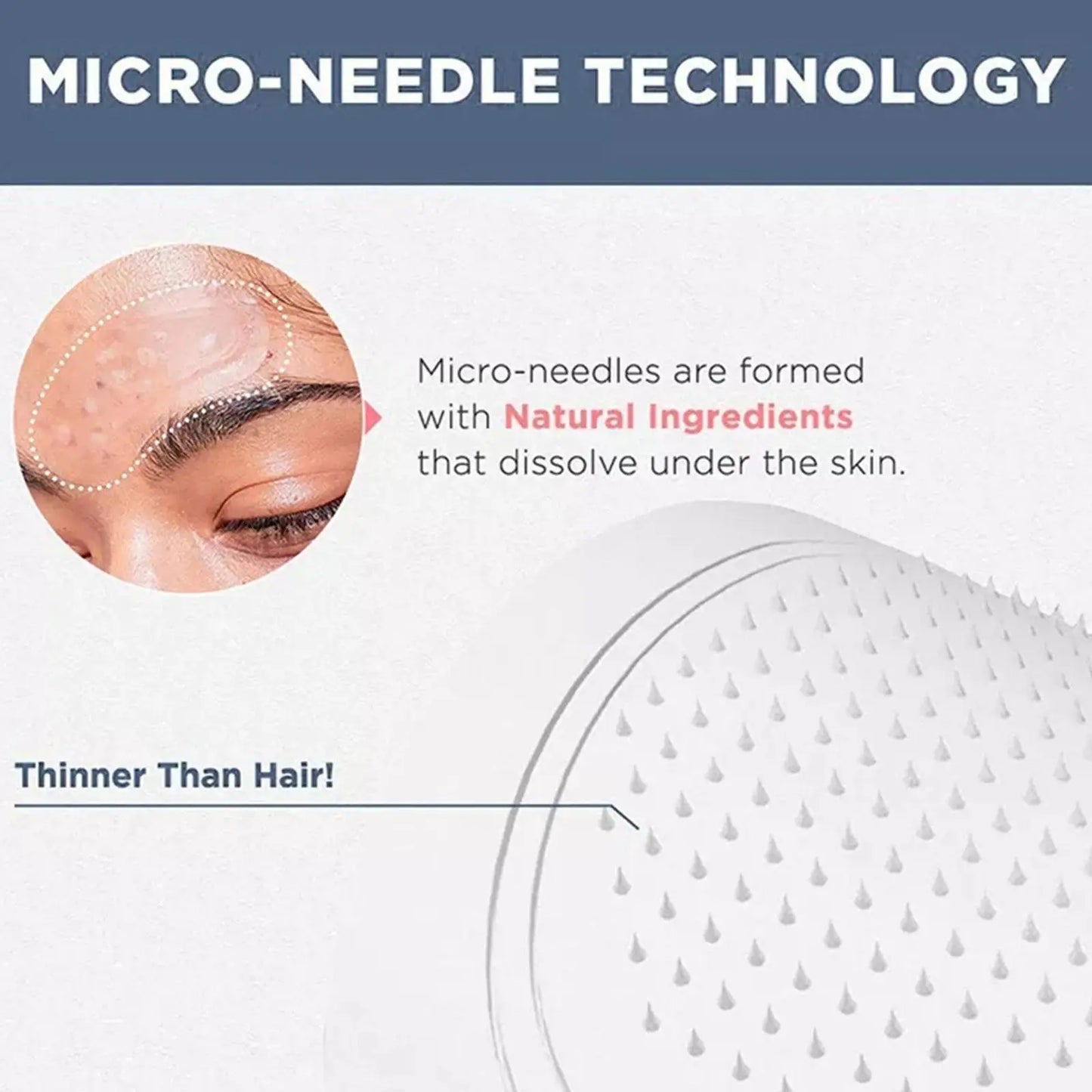 Parches con microagujas de ácido hialurónico – para arrugas, ojeras y líneas de expresión