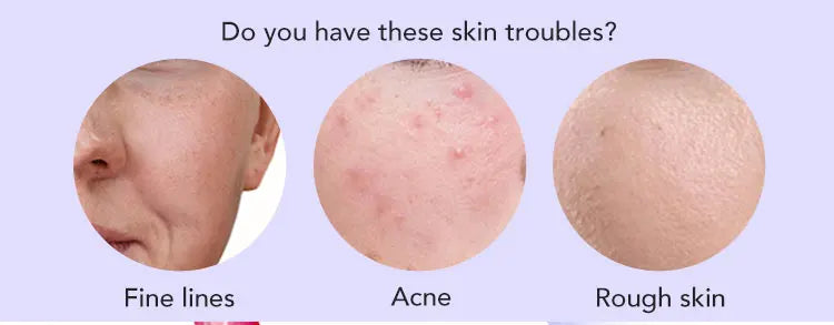 💧 Crema Facial AILKE con Ácido Hialurónico